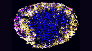 A glioblastoma organoid is shown in high-resolution under the microscope against a black background. The organoid is a mixture of colors, including blue in the center and yellow and purple on the outer edges.