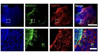 Immunofluorescence images of the heart organoids