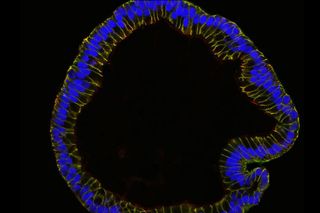 lab-grown Fallopian tubes