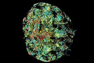 A lab-grown mini-kidney shown in high-resolution under the microscope against a black background.