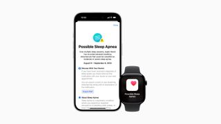 An Apple Watch and iPhone showing the new sleep apnea detection feature in iOS 18/watchOS 11