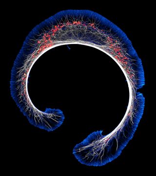 Early stage of mouse glioblastoma cell differentiation (actin, microtubules, and mitocho.