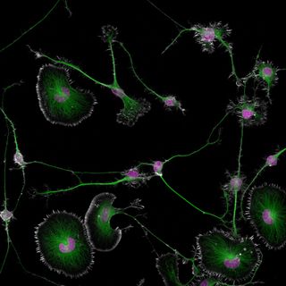 Differentiated mouse brain tumor cells (actin, microtubules, and nuclei)