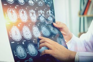 Doctor holding human brain scan images.