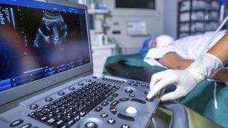 a patient in a hospital gown, mask and hair net lays down while getting an ultrasound screening and a physician is checking the image on a laptop