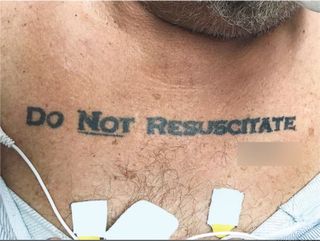 An image showing a patient with the words "do not resuscitated" tattooed on his chest.