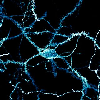 A neuron densely covered in dendritic spines from the striatum of an adult rat brain