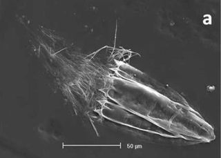 This newfound creature, a loriciferan identified as an undescribed species of the genus Spinoloricus. The creature has specialized organelles so that it can survive without oxygen. Scale bar is 50 microns.