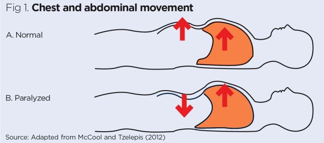 Fig 1 chest and abdominal movement