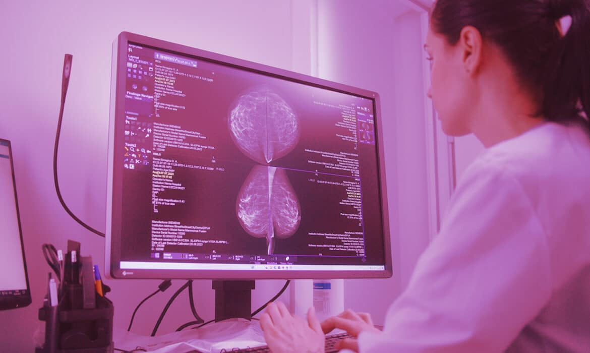 Diagnosing Breast Cancer with AI