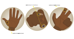 Cancer Researchers need illustrations to help people identify rare skin cancer | Illustration-Design von EA5Designs