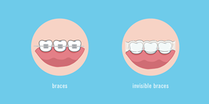 TWO illustrations to be printed on a dental product