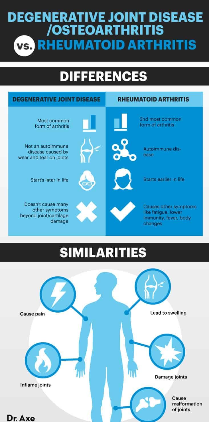 Osteoarthritis vs. rheumatoid arthritis - Dr. Axe