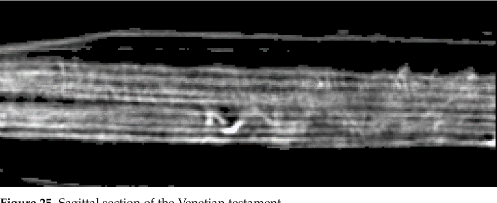 figure 25