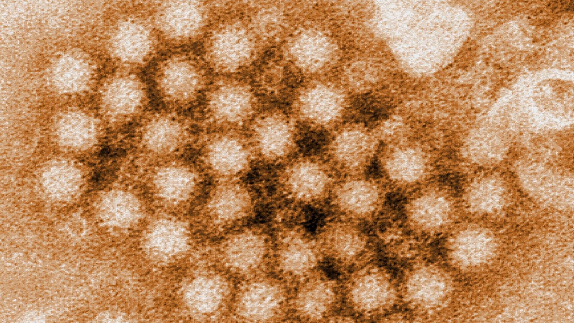 A digitally-colorized, transmission electron microscopic (TEM) image of individual norovirus particles