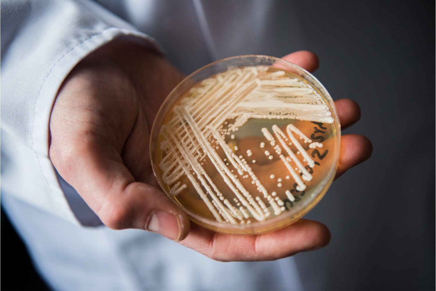 A petri dish containing Candida auris