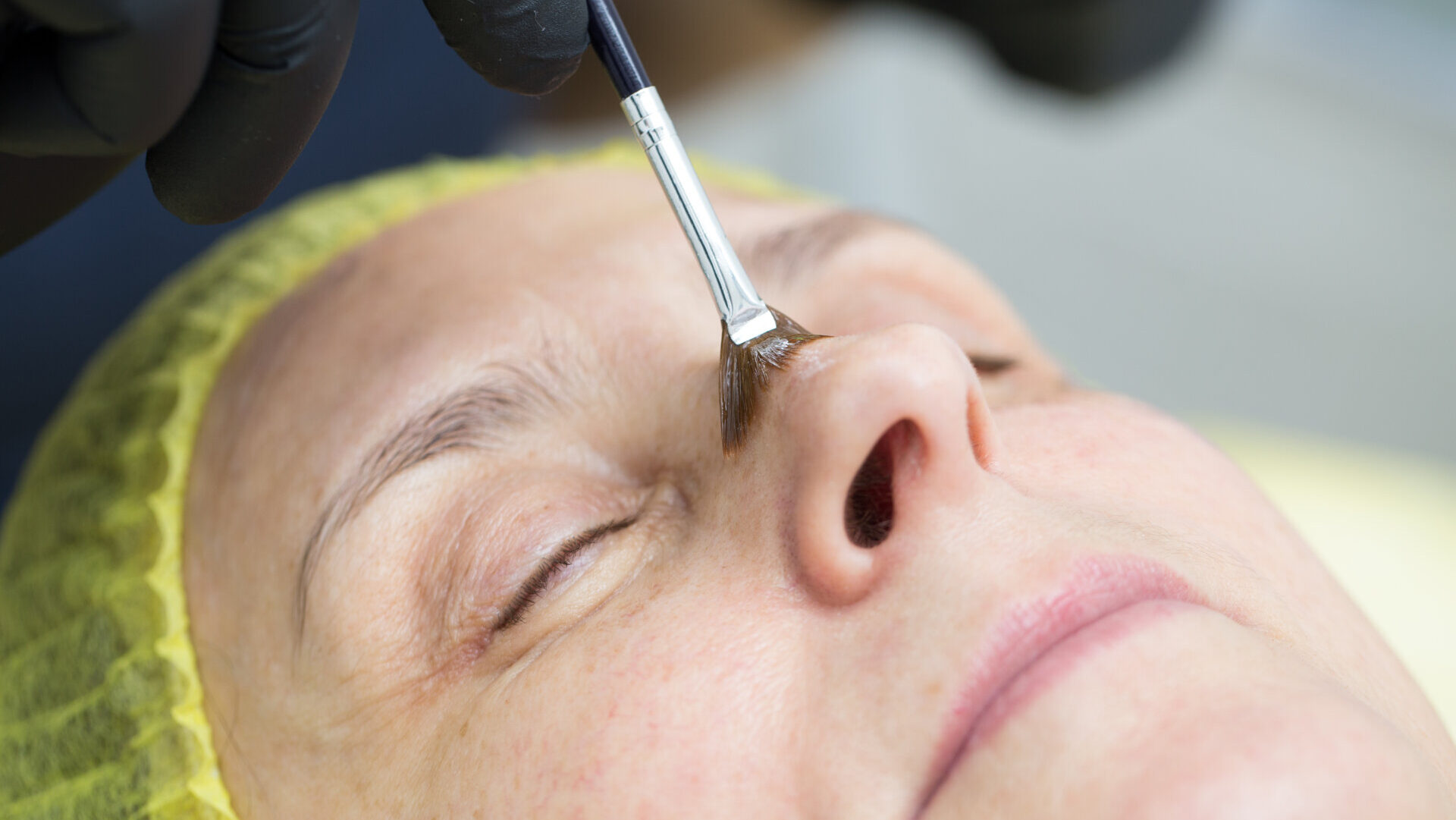 Someone performing a chemical peel in a beauty salon.