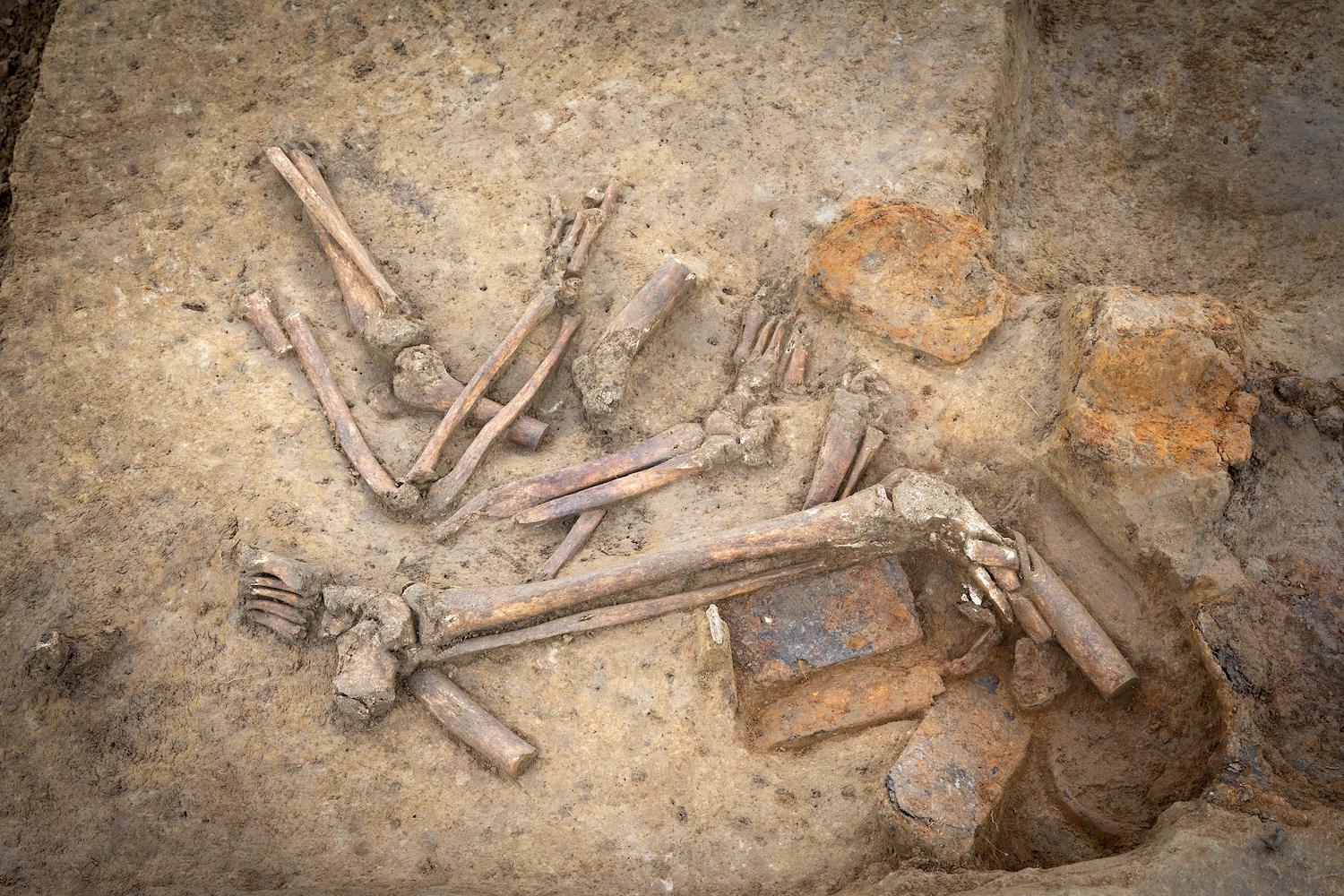 Photo of bones from amputated limbs from Battle of Waterloo