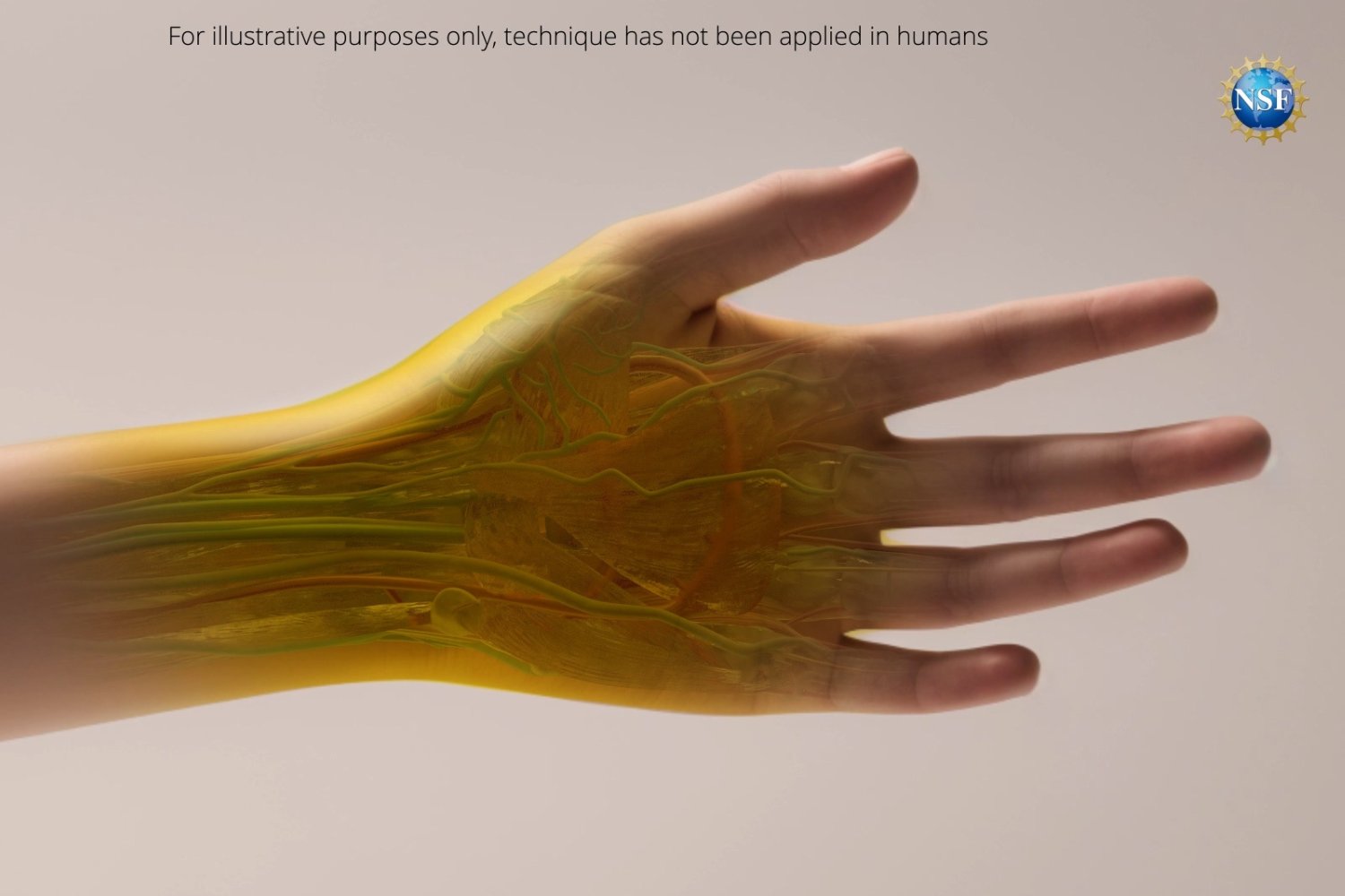 A visualization of see-through, yellow-tinted human skin.