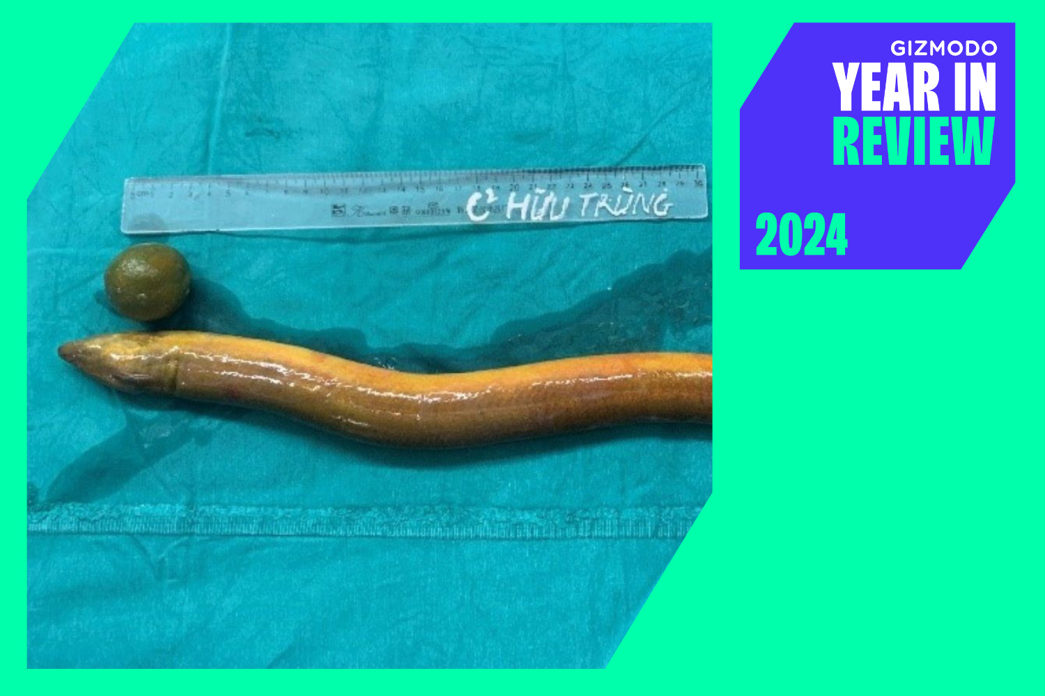 Weirdest Medical Cases 2024