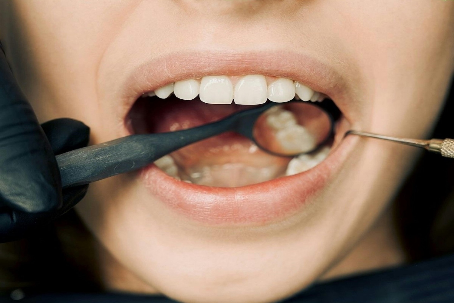 Magnifying Glass And Teeth