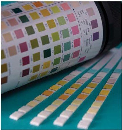 Urinalysis