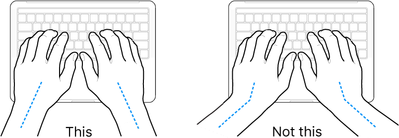 Hands positioned over a keyboard, showing correct and incorrect wrist and hand alignment.