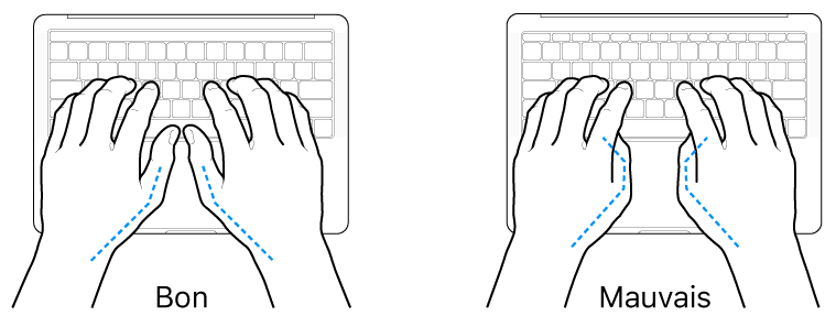 Mains placées sur un clavier, montrant la bonne et la mauvaise position des pouces.