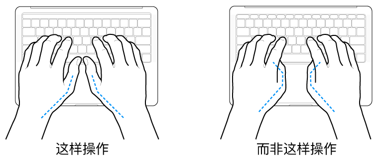 手掌放在键盘上方，显示拇指的正确放置和错误放置。