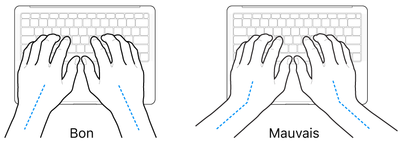 Mains placées sur un clavier, montrant le bon et le mauvais alignement des poignets et des mains.