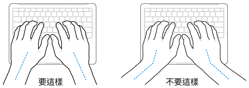 雙手置於鍵盤上，分別顯示正確與不正確的手肘與雙手對稱擺放位置。