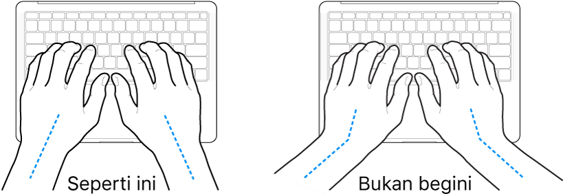 Tangan diposisikan di atas papan ketik, menampilkan penyejajaran pergelangan tangan dan tangan yang benar dan salah.