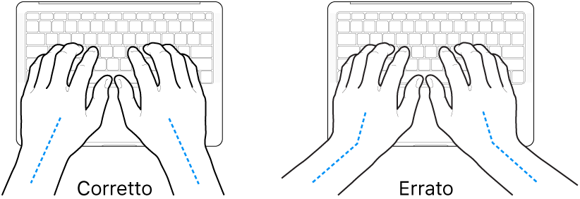 Mani posizionate su una tastiera che illustrano l'allineamento corretto ed errato di polso e mano.