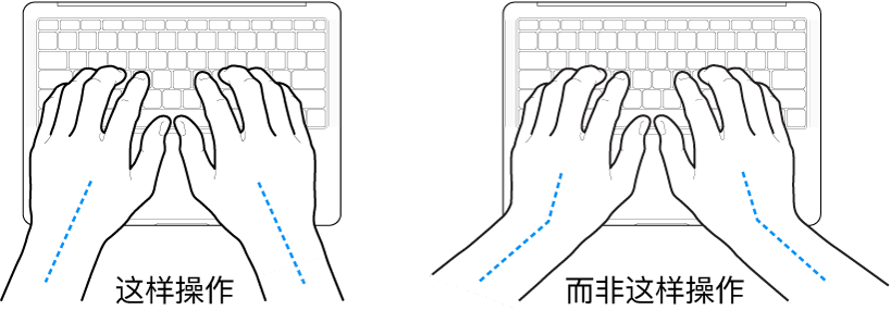 手掌放在键盘上方，显示手腕和手掌的正确对齐位置和错误对齐位置。