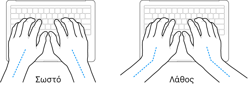 Χέρια τοποθετημένα επάνω σε ένα πληκτρολόγιο, που δείχνουν τη σωστή και τη λανθασμένη θέση των καρπών σε σχέση με τα χέρια.