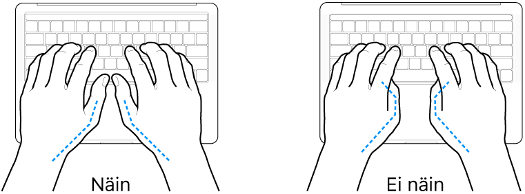 Kädet näppäimistön yllä havainnollistavat peukaloiden oikeaoppista ja virheellistä asentoa.