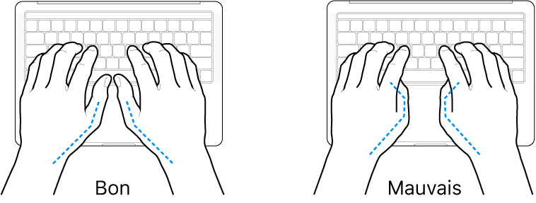 Mains placées sur un clavier, montrant la bonne et la mauvaise position des pouces.