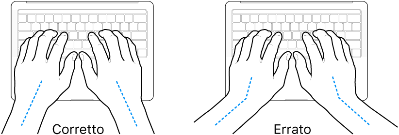 Mani posizionate su una tastiera che illustrano l'allineamento corretto ed errato di polso e mano.