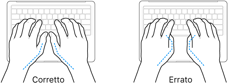 Mani posizionate su una tastiera che illustrano il posizionamento corretto ed errato dei pollici.