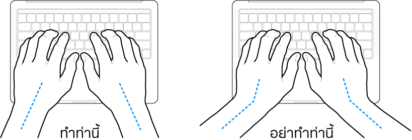มือวางอยู่เหรือแป้นพิมพ์ แสดงตำแหน่งการวางข้อมือและแขนที่ถูกต้องและไม่ถูกต้อง