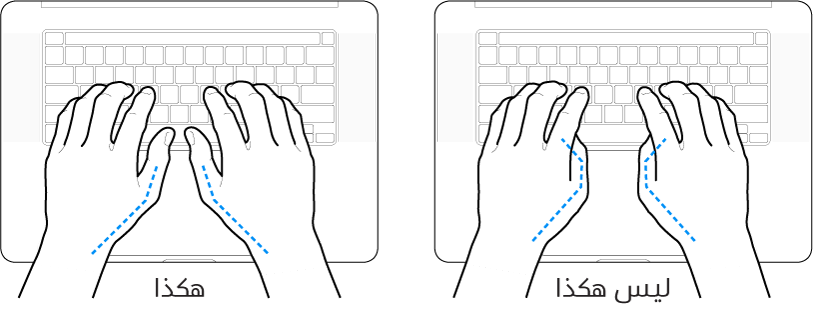 يدان موضوعتان على لوحة مفاتيح، ويظهر الوضع الصحيح وغير الصحيح للإبهامين.
