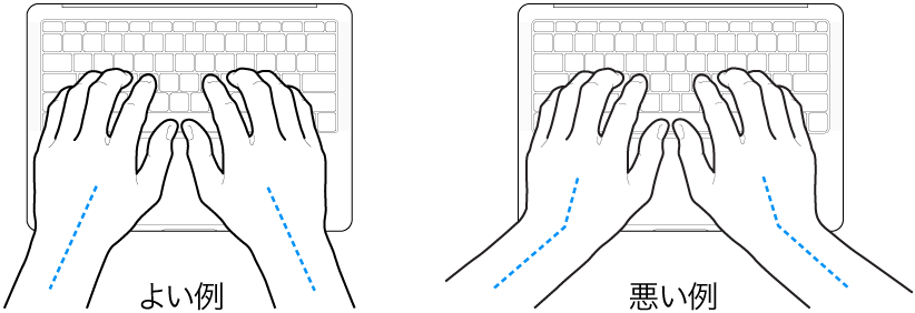 キーボードに置かれた手。手首と手の適切な位置関係と不適切な位置関係を示しています。