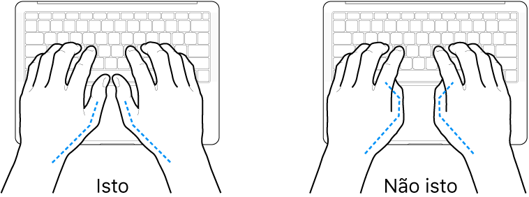 Mãos posicionadas sobre um teclado, mostrando os alinhamentos correto e incorreto dos polegares.