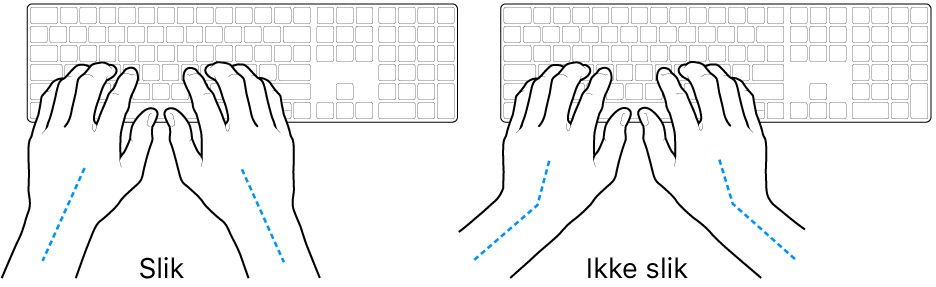 Hender plassert over et tastatur som viser riktig og feil stilling for håndledd og hender.