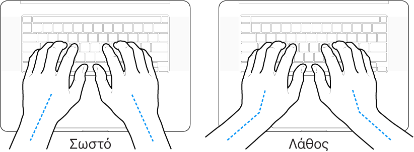 Χέρια τοποθετημένα επάνω σε ένα πληκτρολόγιο, που δείχνουν τη σωστή και τη λανθασμένη θέση των καρπών σε σχέση με τα χέρια.