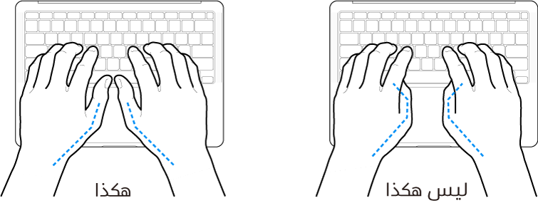 يدان موضوعتان على لوحة مفاتيح، ويظهر الوضع الصحيح وغير الصحيح للإبهامين.