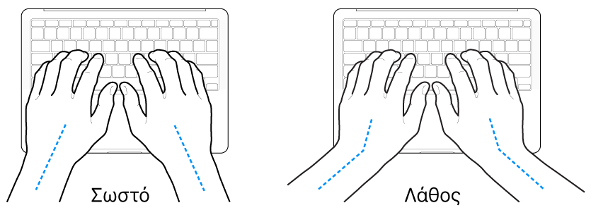 Χέρια τοποθετημένα επάνω σε ένα πληκτρολόγιο, που δείχνουν τη σωστή και τη λανθασμένη θέση των καρπών σε σχέση με τα χέρια.