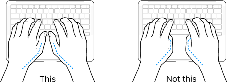 Hands positioned over a keyboard, showing correct and incorrect placement of thumbs.