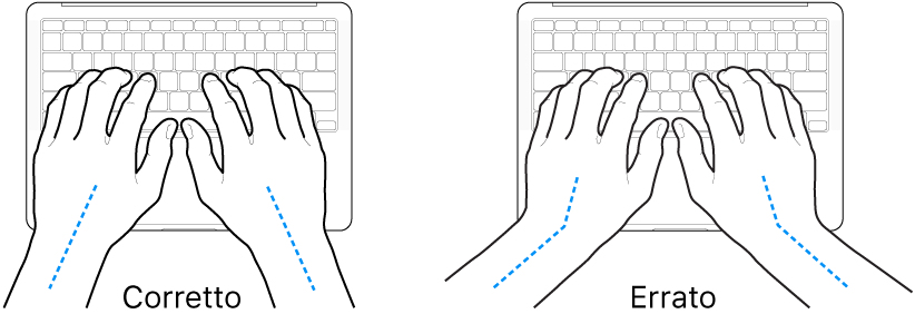 Mani posizionate su una tastiera che illustrano l'allineamento corretto ed errato di polso e mano.