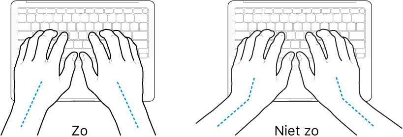 Handen boven een toetsenbord, waarbij de goede en verkeerde stand van de handen en polsen wordt aangegeven.